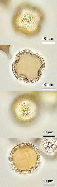 Pollen de {Citrus sinensis} acétolysé en vue polaire et équatoriale - <p>@ Gastaldi, C. - <span class="caps">ANSES</span>/ Gastaldi, E., 2021</p>