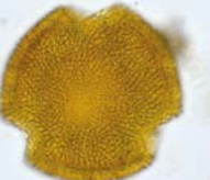 Fiche Palyno - Structure et morphologie d'un grain de pollen