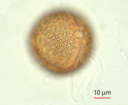 Observation et identification des grains de pollen