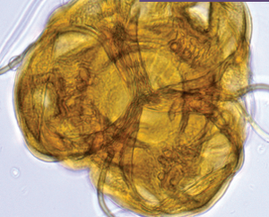 Notions de base en palynogénèse et morphologie du pollen