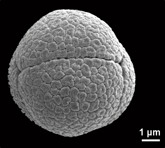  Pollen de {Mimosa pudica} en microscopie électronique - <p>@ Halbritter H., Heigl H. 2021</p>